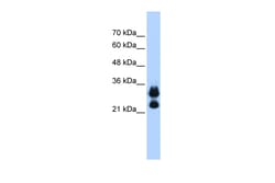 Aviva Systems Biology Corp HIST1H1C Antibody - middle region (ARP46122_P050)