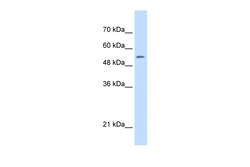 Aviva Systems Biology Corp SHMT2 Antibody - C-terminal region (ARP46129_P050)