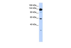 Aviva Systems Biology Corp VARS Antibody - middle region (ARP46151_P050)