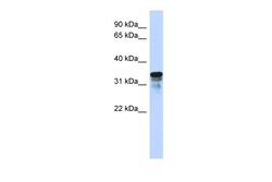 Aviva Systems Biology Corp FAM82B Antibody - N-terminal region (ARP46236_P050)