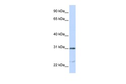 Aviva Systems Biology Corp NUSAP1 Antibody - C-terminal region (ARP46245_P050)