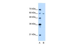 Aviva Systems Biology Corp CEP55 Antibody - N-terminal region (ARP46272_P050)