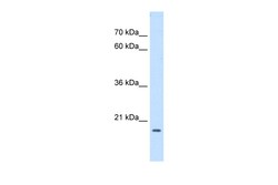 Aviva Systems Biology Corp ASF1B Antibody - middle region (ARP46276_P050)