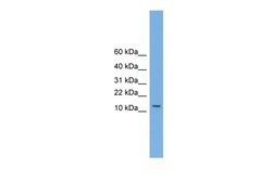 Aviva Systems Biology Corp MAGEA5 Antibody - N-terminal region (ARP46295_P050)