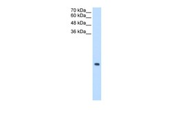 Aviva Systems Biology Corp MRPS12 Antibody - N-terminal region (ARP46301_P050)