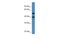 Aviva Systems Biology Corp Nup37 Antibody - N-terminal region (ARP46327_P050)