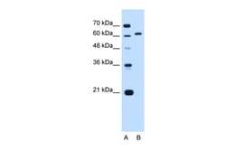 Aviva Systems Biology Corp LMNB2 Antibody - N-terminal region (ARP46356_P050)