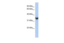 Aviva Systems Biology Corp DLK1 Antibody - middle region (ARP46375_P050)