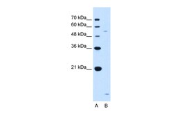 Aviva Systems Biology Corp ST3GAL5 Antibody - N-terminal region (ARP46385_T100)
