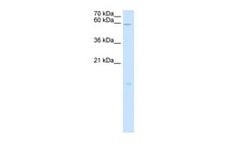 Aviva Systems Biology Corp RARRES3 Antibody - middle region (ARP46474_T100)