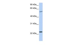 Aviva Systems Biology Corp SYNGR2 Antibody - N-terminal region (ARP46485_P050)