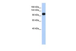 Aviva Systems Biology Corp ATP2A3 Antibody - middle region (ARP46580_P050)