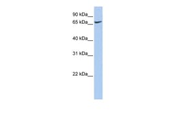 Aviva Systems Biology Corp ATP6V0A1 Antibody - N-terminal region (ARP46581_P050)