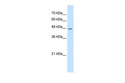 Aviva Systems Biology Corp DDOST Antibody - N-terminal region (ARP46585_T100)