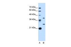Aviva Systems Biology Corp ST8SIA2 Antibody - C-terminal region (ARP46681_P050)