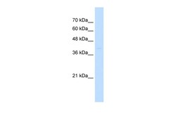 Aviva Systems Biology Corp ST3GAL3 Antibody - N-terminal region (ARP46706_P050)