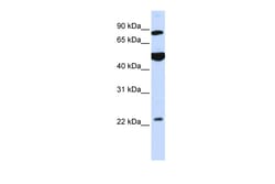 Aviva Systems Biology Corp GCS1 Antibody - N-terminal region (ARP46708_P050)