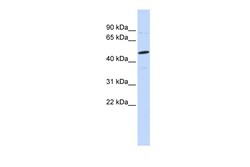 Aviva Systems Biology Corp CSPG5 Antibody - N-terminal region (ARP46737_P050)