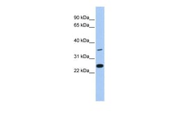 Aviva Systems Biology Corp LYVE1 Antibody - N-terminal region (ARP46761_P050)