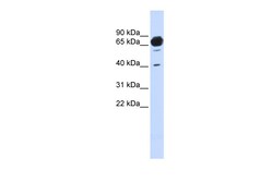 Aviva Systems Biology Corp MAN1A2 Antibody - middle region (ARP46766_P050)