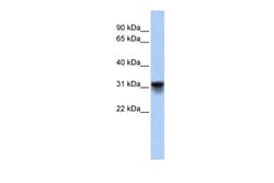 Aviva Systems Biology Corp KDELR3 Antibody - middle region (ARP46794_P050)