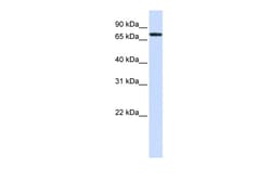 Aviva Systems Biology Corp GALNT6 Antibody - middle region (ARP46837_P050)