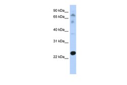 Aviva Systems Biology Corp CHIC2 Antibody - N-terminal region (ARP46857_P050)