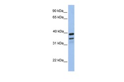Aviva Systems Biology Corp FKBP8 Antibody - N-terminal region (ARP46862_P050)