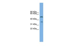 Aviva Systems Biology Corp B3GAT3 Antibody - N-terminal region (ARP46864_P050)