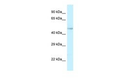 Aviva Systems Biology Corp Tmem184b Antibody - middle region (ARP46876_P050)