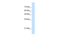 Aviva Systems Biology Corp LETM1 Antibody - middle region (ARP46881_T100)