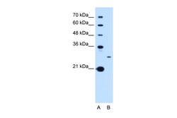 Aviva Systems Biology Corp TSPAN15 Antibody - C-terminal region (ARP46889_P050)