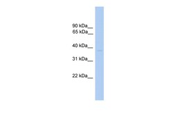 Aviva Systems Biology Corp ST6GALNAC6 Antibody - N-terminal region (ARP46951_P050)