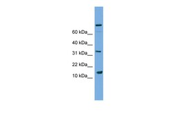 Aviva Systems Biology Corp PLA2G2E Antibody - middle region (ARP47041_P050)