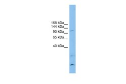 Aviva Systems Biology Corp CLSTN3 Antibody - N-terminal region (ARP47060_P050)