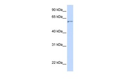 Aviva Systems Biology Corp DHCR24 Antibody - N-terminal region (ARP47072_P050)