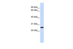 Aviva Systems Biology Corp DULLARD Antibody - middle region (ARP47144_P050)