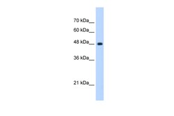 Aviva Systems Biology Corp UNC84B Antibody - C-terminal region (ARP47148_P050)