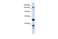 Aviva Systems Biology Corp ABI3BP Antibody - N-terminal region (ARP47157_P050)