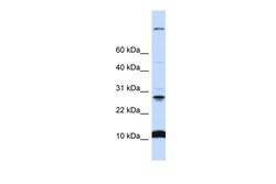 Aviva Systems Biology Corp C19orf56 Antibody - N-terminal region (ARP47218_P050)