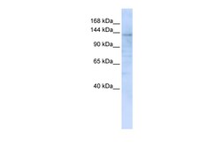 Aviva Systems Biology Corp IMPG2 Antibody - C-terminal region (ARP47238_P050)