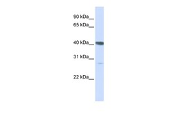 Aviva Systems Biology Corp DNAJB11 Antibody - C-terminal region (ARP47245_P050)