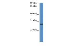 Aviva Systems Biology Corp Clec1b Antibody - N-terminal region (ARP47260_P050)