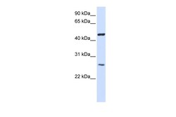 Aviva Systems Biology Corp TMEM127 Antibody - middle region (ARP47363_P050)