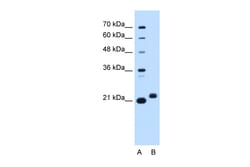 Aviva Systems Biology Corp C1orf159 Antibody - middle region (ARP47373_P050)