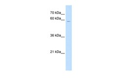 Aviva Systems Biology Corp CSGALNACT1 Antibody - N-terminal region (ARP47434_P050)