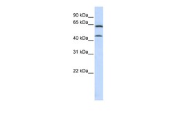 Aviva Systems Biology Corp ChGn Antibody - C-terminal region (ARP47435_P050)
