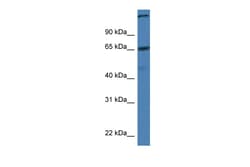 Aviva Systems Biology Corp St6galnac1 Antibody - C-terminal region (ARP47445_P050)