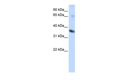 Aviva Systems Biology Corp ST6GALNAC1 Antibody - middle region (ARP47446_P050)