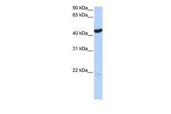 Aviva Systems Biology Corp KRT23 Antibody - middle region (ARP47466_P050)